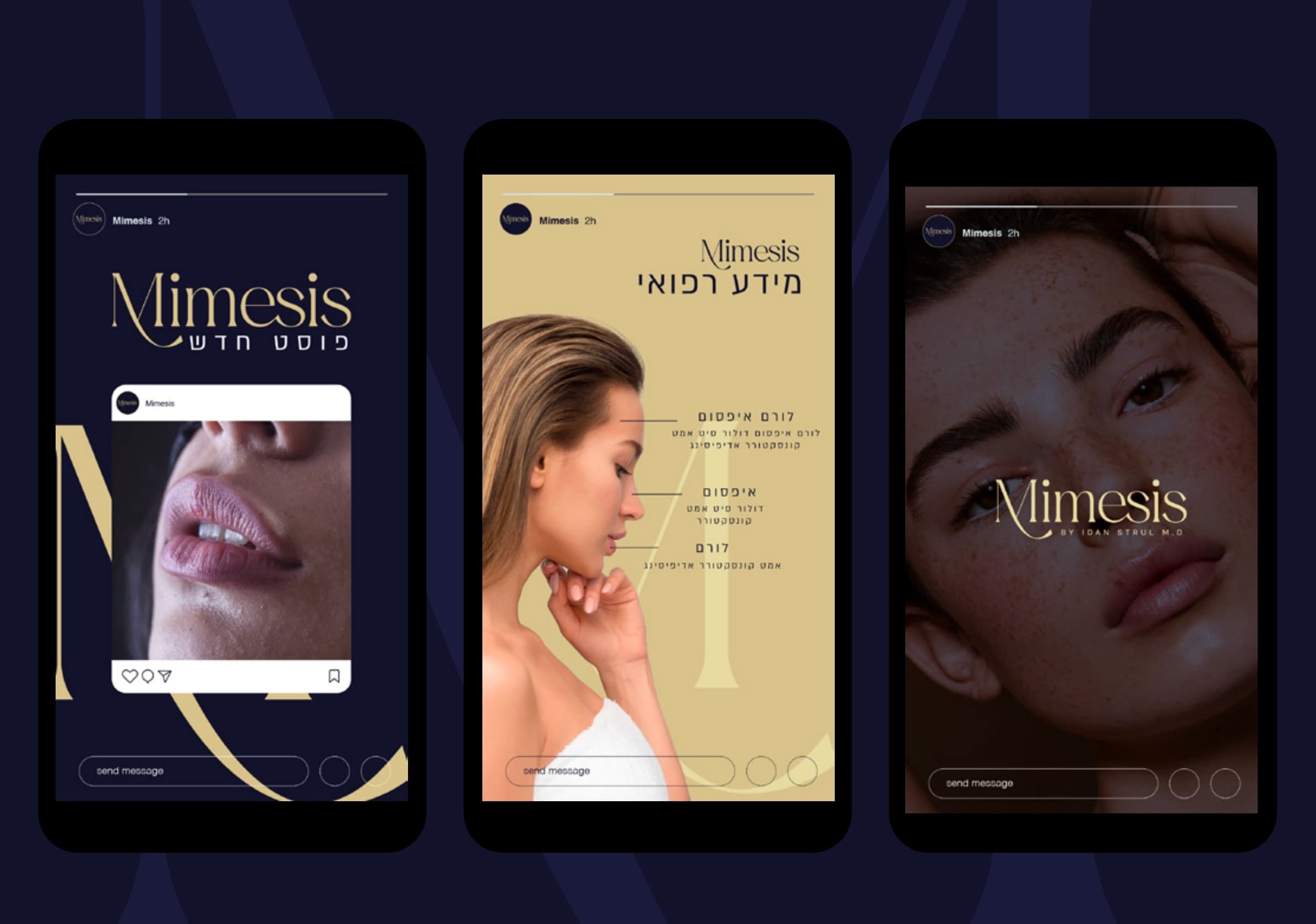 Mimesis — תמונה 3